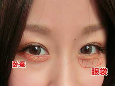 臥蠶還是眼袋?別再傻傻分不清瞭 臥 <div>
<p class=