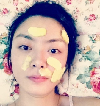 生薑能去痘印嗎 生薑能去痘印嗎