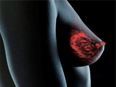 乳房疾病的癥狀是什麼樣的
