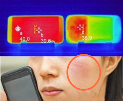 少女手機發熱被燙傷怎麼處理 手機發熱能到多少度手機如何降溫