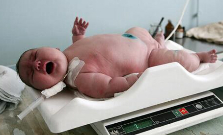 產婦產下12.9斤巨嬰驚呆眾人 新生兒體重多少正常揭體重計算公式