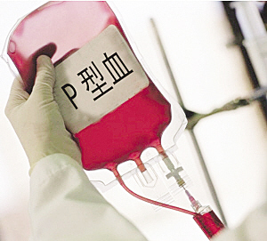 p型血可以輸給非p型血的人嗎 科普一下什麼是P型血到底多稀有