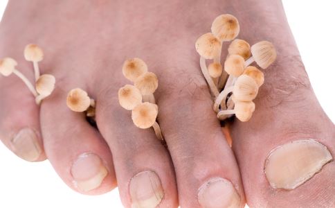 腳臭是什麼原因 腳臭的原因有哪些 腳臭怎麼辦