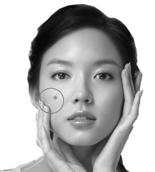 臉上長痘怎麼辦 四大事項需註意 臉上長痘怎麼辦 四大事項需註意
