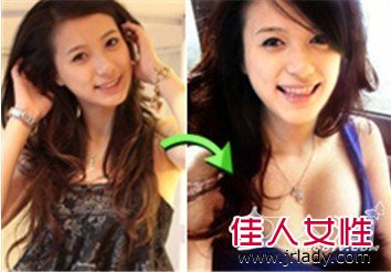 最快速安全有效的豐胸方法