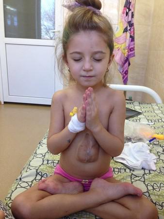 俄5歲女孩心臟長在胸腔外僅一層皮膚保護 心臟外露能活多久