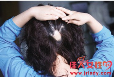 女子清明節被\"鬼剃頭\" 專傢稱壓力大成斑禿