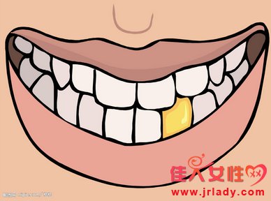 7大因素導致牙齒不白，你中招瞭嗎？