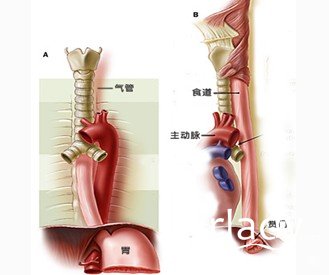 哪些蔬菜可預防食道癌